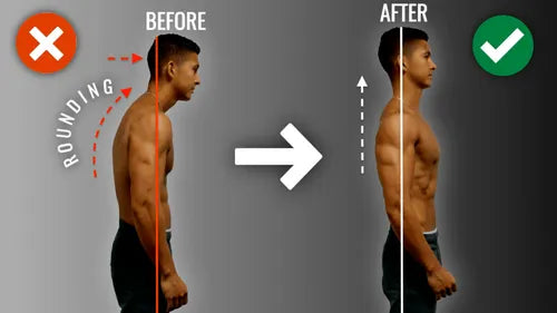 Rounded Shoulders From Desk Work: Causes and Fix